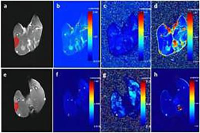 Microvascular Permeability and Texture Analysis of the Skeletal Muscle of Diabetic Rabbits With Critical Limb Ischaemia Based on DCE-MRI